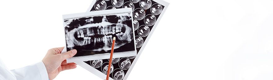 Oralchirurgie